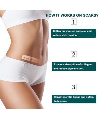 Medical Grade Silicone Scar Sheets 1.6x120 Inch - Reusable Tape Roll for Scar Removal on Face & Body - Surgery, C-Section, Keloid, Burn, Acne - Buy Online on GoSupps.com