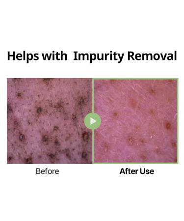 DINSEE Premium Vegan Low pH Hyaluronic Acid Foam Cleanser- Non-Stripping Daily Face Wash For All Skin Types Gentle Korean Face Cleansing Foam Low pH 50ml/ 5.07 fl oz - Buy Online on GoSupps.com