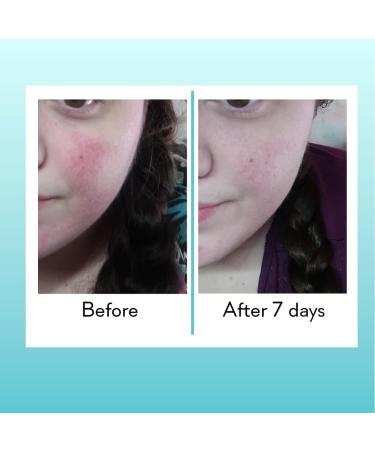 Marine Elements Soothing Face Mask 50ml Hydrating Skincare Mask Rapid Relief from the Signs of Dry Skin: Itchy Red Flaky Sensitive Dehydrated Skin. With Sea Chamomile Fragrance Free - Buy Online on GoSupps.com