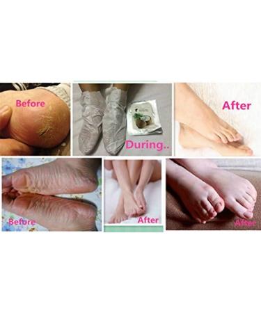 Elitzia ETEF4001 Coconut Oil Nourishing Foot Mask 5 Pieces A Box Repair Dry - Buy Online on GoSupps.com