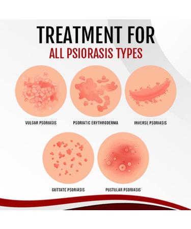 LELEBEAR Dermax Psoriasis Treatment Spray - Soothes Skin, Stops Burning and Itching (5 Pack) - Buy Online on GoSupps.com