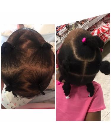 J Organic Solutions Kids Biotin Growth Stimulating Conditioner | 8oz with Argan Oil & Aloe Vera - International Shipping Available - Buy Online on GoSupps.com