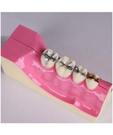 Fhuili teeth model for training - at the bottom right of the teeth organizational recovery model - simulation oral tooth -tooth demonstration model - for studying a