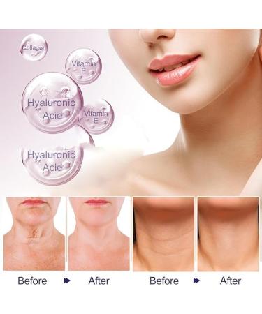 (Most Gifted) 2024 New 1/2/3 Jars Pure Tighten & Lift Neck Cream Go Neck Firming Cream | Anti-Aging Neck Cream for Tightening and Wrinkles for an Even Skin Tone and Neck Lift - 50ml/1.7fl.oz (3 Jars Tighten & Lift Neck Cream) - Buy Online on GoSupps.com