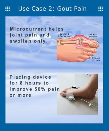PainKARE Patch Microcurrent Device for Chronic Joint Pains One Device and 8 electrodes (up to 12 Treatments) - Buy Online on GoSupps.com