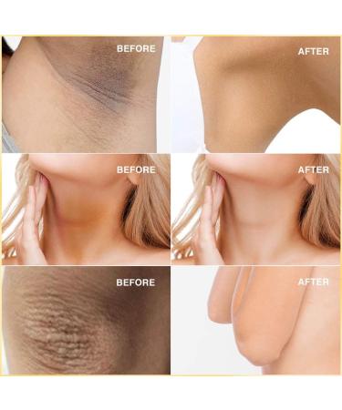 BEROZA 2Pcs Crema Reparadora Para Manchas Oscuras 50ml Vitamin C Body Moisturizer Cream Crema ntima para mujeres Adecuado para varias reas como cara axilas cuello zona privada - Buy Online on GoSupps.com