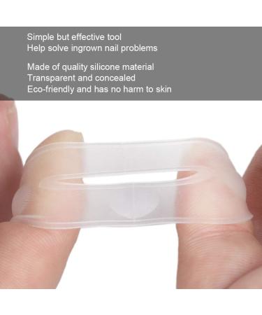 Ejoyous 2pcs Outil de Correction D'ongle incarn en Silicone Autocollants de Correction des Ongles Correcteur Bande Clip Traitement de Soulagement de la Douleur Correcteur - Buy Online on GoSupps.com