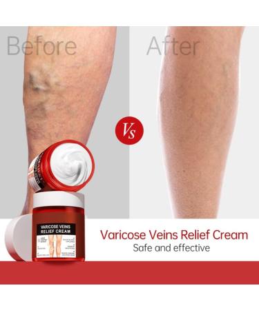  spier Spier Varicose Vein Cream 80g cream against varicose veins varicose veins varicose veins and varicose veins to remove from legs ointment care - Buy Online on GoSupps.com