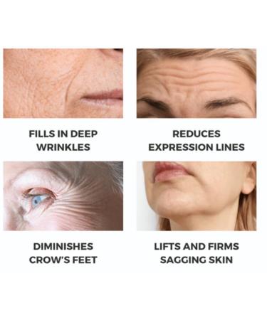 Noviqo Freeze Dried Collagen for Face Anti-Wrinkle Nano-Silk Collagen System Serum Skin Care for Face & Eye At-Home-Hydrating - Buy Online on GoSupps.com