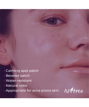 ISNTREE Onion Newpair Pimple Patch - 24 Water-Resistant Blemish & Spot Care Patches in 2 Sizes | International Shipping Available - Buy Online on GoSupps.com