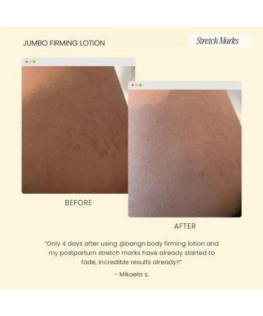 Firming Body Lotion - Hydrating Skin Moisturizer for Smoother Toned and Nourished Skin Lightweight Daily Cream for All Skin Types - (13.5 fl.oz) - Fragrance Free - Buy Online on GoSupps.com