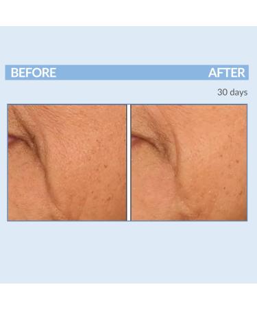 Retinol Fine Lines and Wrinkles Skin Care Set - A Force XR Serum and A Cream XR Moisture Cream for Face - Anti-Aging - Minimize Post Acne Marks - Resurface and Hydrate - Serious Skincare - Buy Online on GoSupps.com