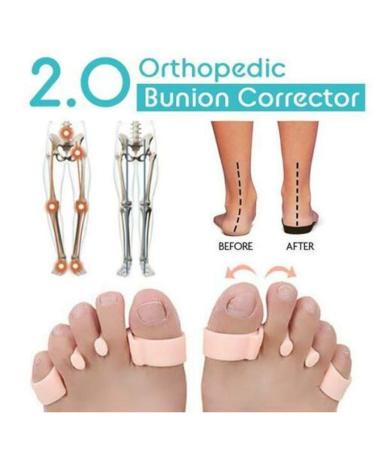 VIEEL Orthopedic Bunion Corrector Gel Toe Stretcher - 3 Pairs, Beige - Buy Online on GoSupps.com