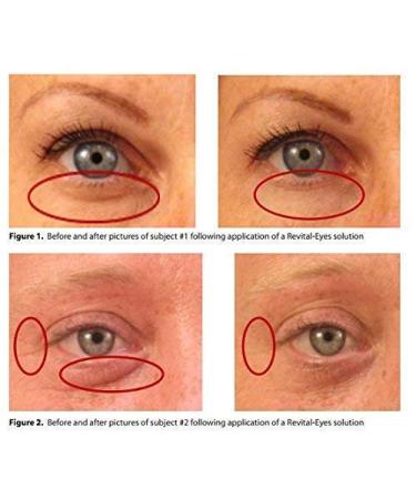 Brightening Under Eye Serum | Lunar Glow | Refreshing Eye Care for Dark Circles & Puffiness | 10ml - Shop Internationally - Buy Online on GoSupps.com