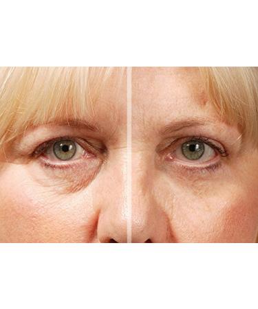 Rox Flawless Eyes by RX | Premium Eye Care for Radiant Skin | Shop Internationally Now - Buy Online on GoSupps.com