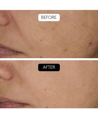 COCUNAT SL CLINICAL BEAUTY FILLER AntiWrinkle Treatment 1 Application Stimulates Collagen Combats Skin Sagging Simple Painless and Safe With Hyaluronic Acid and Peptides Argyle - Buy Online on GoSupps.com