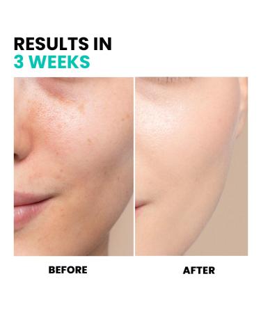 Conatural Brightening Serum 30ml | Radiant Face Serum for Even Skin Tone & Hydration | Antioxidant-Infused Water-Based Formula for Luminous Complexion - Buy Online on GoSupps.com