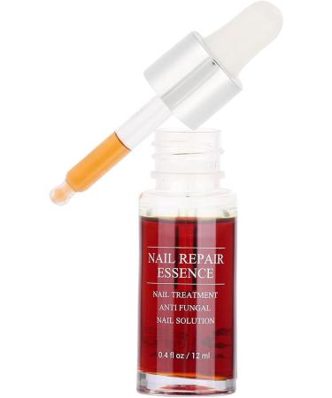 Nail Repair Essence 15ML Nail Fungus Treatment Natural Nail Care Toe Nail Fungus Treatment for Damaged Discolored Nails Antifungus Nail Treatment - Buy Online on GoSupps.com