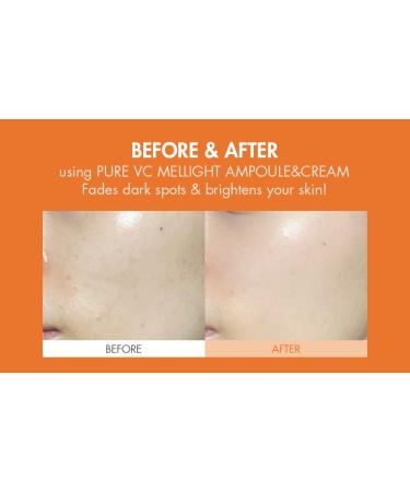 Dr.Ceuracle Pure Vitamin C Mellight Cream | Tone-Up Serum for Face | Anti-Aging Moisturizer | Brighten Dark Spots & Wrinkles | Paraben-Free | Shop Internationally - Buy Online on GoSupps.com
