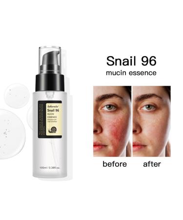 100ML Snail Mucin Serum - Advanced Snail 96 Essence for Dark Spots Moisture & Skin Vitality | International Shipping - Buy Online on GoSupps.com