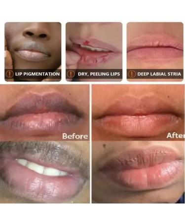 Remove Dark Lip Balm Lightening Melanin Gloss Oil Exfoliating Clean Moisturizer Make up Lip Color Scrub Exfoliator Care - Buy Online on GoSupps.com