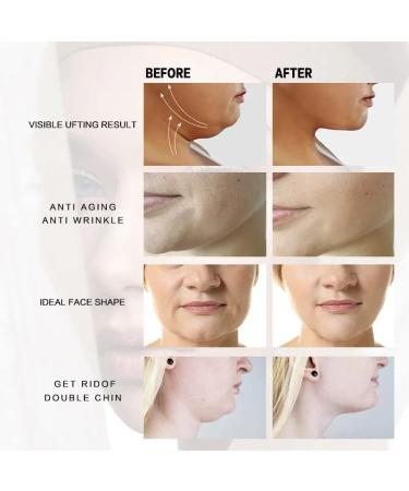 Double Chin Eliminator Hydrogel Masks - 5 Pack with Hyaluronic Acid & Aloe Vera for Anti-Aging & Face Tightening - Buy Online on GoSupps.com