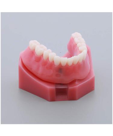 Fhuili teeth model for education-repair implant teeth model-doctor-patient-communication red dentition model simulation oral dental tooth demonstration model a