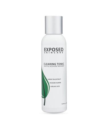 Exposed Skin Care Clearing Tonic Step 2 - Acne Clearing Toner Treatment   Prevent Breakouts and Redness with Salicylic Acid 1.0%  Witch Hazel and Green Tea - 4 fl oz