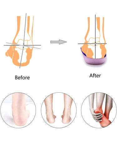 PCSsole 3/4 Orthotic Arch Support Insoles - High Arch Support for Plantar Fasciitis, Flat Feet, Over-Pronation, Heel Pain - Men and Women - Blue - UK-M(6-8) - Buy Online on GoSupps.com