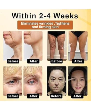 Kanoauo Apisderm Botoxbee Advanced MultiAction Festing Cream Bee strengthening cream advanced fortressing and wrinkle reduction cream for all skin types 100 g - Buy Online on GoSupps.com