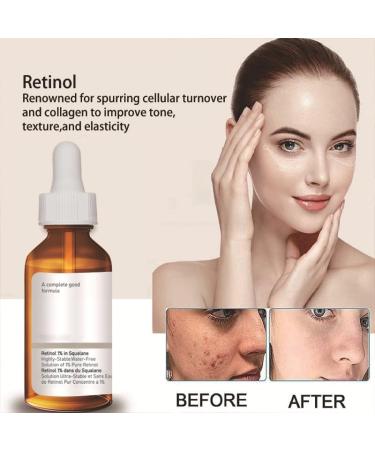 Retinol Serum For Face/Neck/Eyes - Retinol 1% in Squalane 30ml - High-Strength Face Serum for Activate Skin- Anti Aging Facial Serum for Moisturizing Fine Line Skin Repair - Buy Online on GoSupps.com