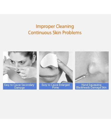 FEDRUI HD Visual Blackhead Remover Electric Pore Cleansing Facial Blackheads Suction Device Blackhead Extractor Tool with 6 LED Fill Lights for Home Bathroom - Buy Online on GoSupps.com