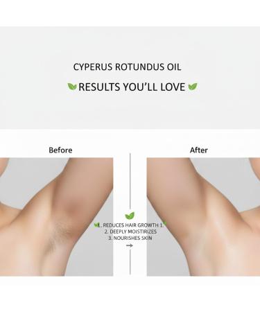 2PCS Cyperus Rotundus Oil For Hair Removal Natural Herbal Product Reduces Hair Growth Suitable For All Skin Types - Buy Online on GoSupps.com