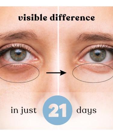 The CuraTeam EZYROLL Under Eye Roll On Serum with Hyaluronic Acid Natural Caffeine | Cooling Massage Roller to Reduce Dark Circles Puffiness & Fine Lines | For All Skin Types of Men & Women|15ml - Buy Online on GoSupps.com