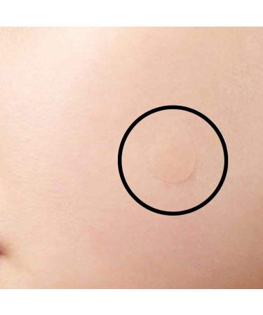 Spot Acne Patch - 72 Hydrocolloid Patches for Effective Skin Blemish Treatment | Blemish Acne Dots - Fast Shipping Worldwide - Buy Online on GoSupps.com