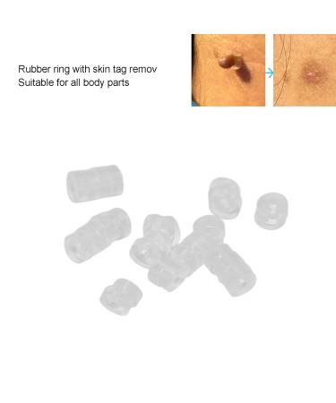 30-Piece Skin Tag Remover Rubber Bands for Small Tags | Effective Mole & Facial Care Tool (4-8mm) - International Shipping Available - Buy Online on GoSupps.com