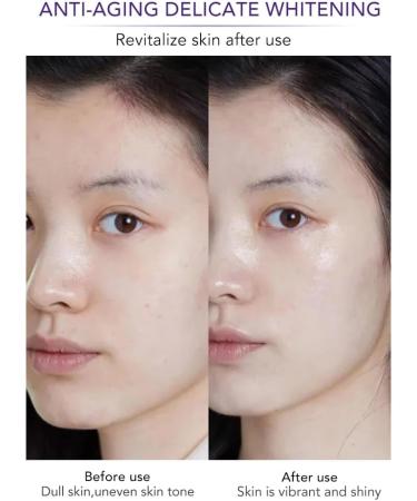 AILKE Nettoyant visage blanchissant anti- ge contr le de l'huile nettoie les pores r duit les points noirs et les boutons ne dess che pas la peau pour tous les types de peau nettoyant pour le 1 pi ce. - Buy Online on GoSupps.com