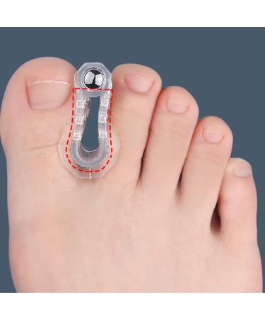 Feelsploh Toe Valgus Relief - 2 Piece Elastic Soft Iron for Hallux Protection & Daily Comfort - Non-Slip Foot Accessories - Buy Online on GoSupps.com