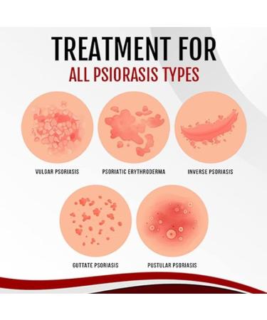 3Pcs Dermax Psoriasis Treatment Spray- Soothing Coal Tar Cream for Moisturizing Relief - Buy Online on GoSupps.com