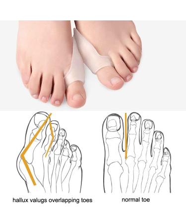 VIEEL Gel Toe Separator Bunion Corrector - 5 Pairs for Pain Relief and Toe Alignment | Ideal for Dancers, Yogis, Athletes | Men and Women - Buy Online on GoSupps.com
