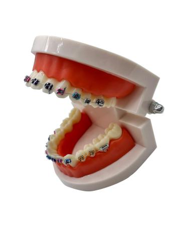 Dental Orthodontic Model with Metal Brackets and Arch Wire - Standard Teeth Model with Braces for Demonstration - Buy Online on GoSupps.com