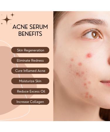  BRITAINS BEAUTY 4 in 1 Vitamin C Face Serum - Organic Skin Care for Whitening Moisturizing Anti-Aging and Acne Control for All Skin Types - 30ml - Buy Online on GoSupps.com