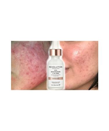 Revolution Skin Acne Stains and Pore Cleansing Miraculous Serum B3 Vitamin + %1 Zinc-30ml - Buy Online on GoSupps.com