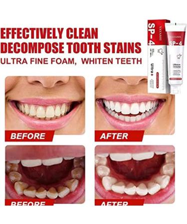 Yayashi SP-4 Probiotic Toothpaste - 2-Piece Whitening Set for Stain Removal & Brightening Teeth - Buy Online on GoSupps.com