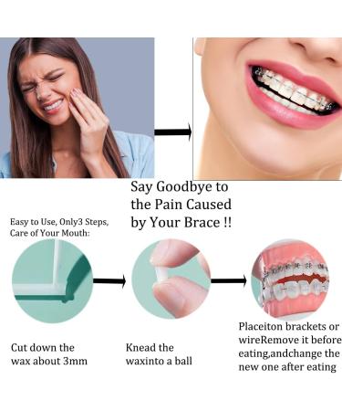 Braces Wax - 50 Strips of Orthodontic Tooth Wax | Protect Your Mouth from Friction | 10 Flavors Available - Buy Online on GoSupps.com