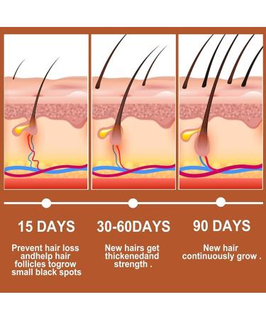 30ml Ginger Hair Growth Serum Hair Growth Treatment Oil for Men Women Anti Hair Loss Thinning Promote Hair Regrowth - Buy Online on GoSupps.com