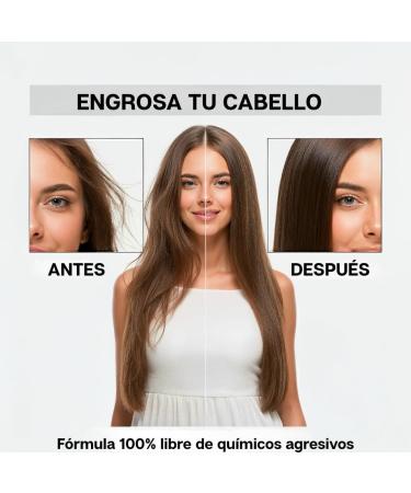 Apr s-shampooing la Biotine pour les Cheveux Collag ne Huile d'Argan Huile de Jojoba et Huile de Macadamia avec 18 Vitamines pour les Cheveux I Pr vient et aide r duire la chute XXL 400 ml - Buy Online on GoSupps.com