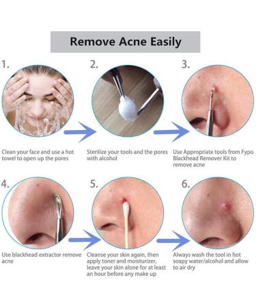 Blackhead Remover Tool Kit with Facial Cleansing Brush 3 Pieces Comedone Extractor Tool Blemish Whitehead Removal Acne Needle Pimple Spot Popper with Cleansing Blackhead Brush - Buy Online on GoSupps.com