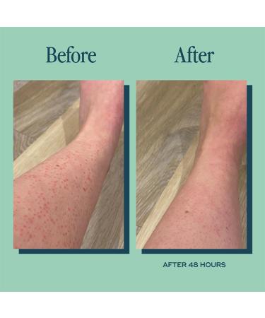 Everywhere Oil 10ml - Hydrating Body Oil for Women | Natural Moisturizer for Ingrown Hair | Travel Size | International Shipping Available - Buy Online on GoSupps.com