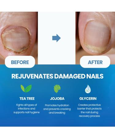 Nail Strengthener Kit - Glass Nail File Growth Oil & Hardener for Damaged Nails - Yellow Nail Care Solution for Stronger Nails - Buy Online on GoSupps.com